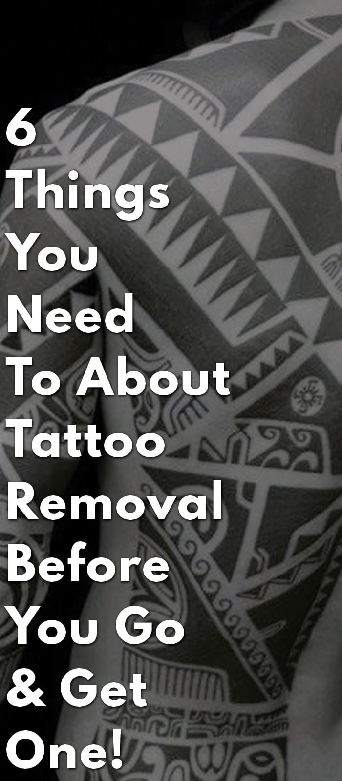 6-Things-You-Need-To-About-Tattoo-Removal-Before-You-Go-&-Get-One!