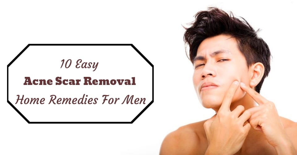 10 Easy Acne Scar Removal Home Remedies For Men