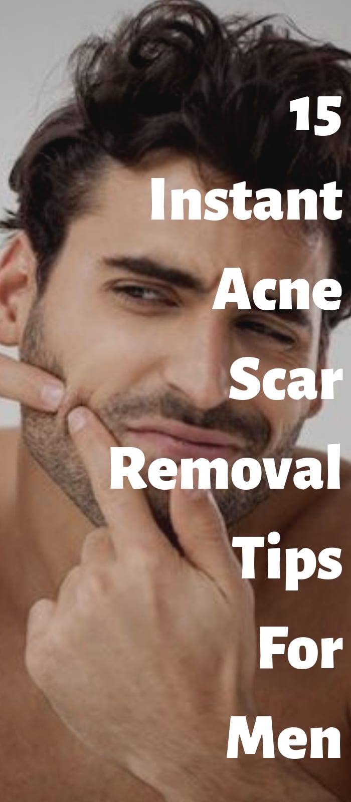 15 Instant Acne Scar Removal Tips For Men