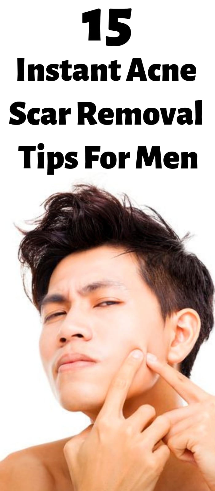15 Instant Acne Scar Removal Tips For Men