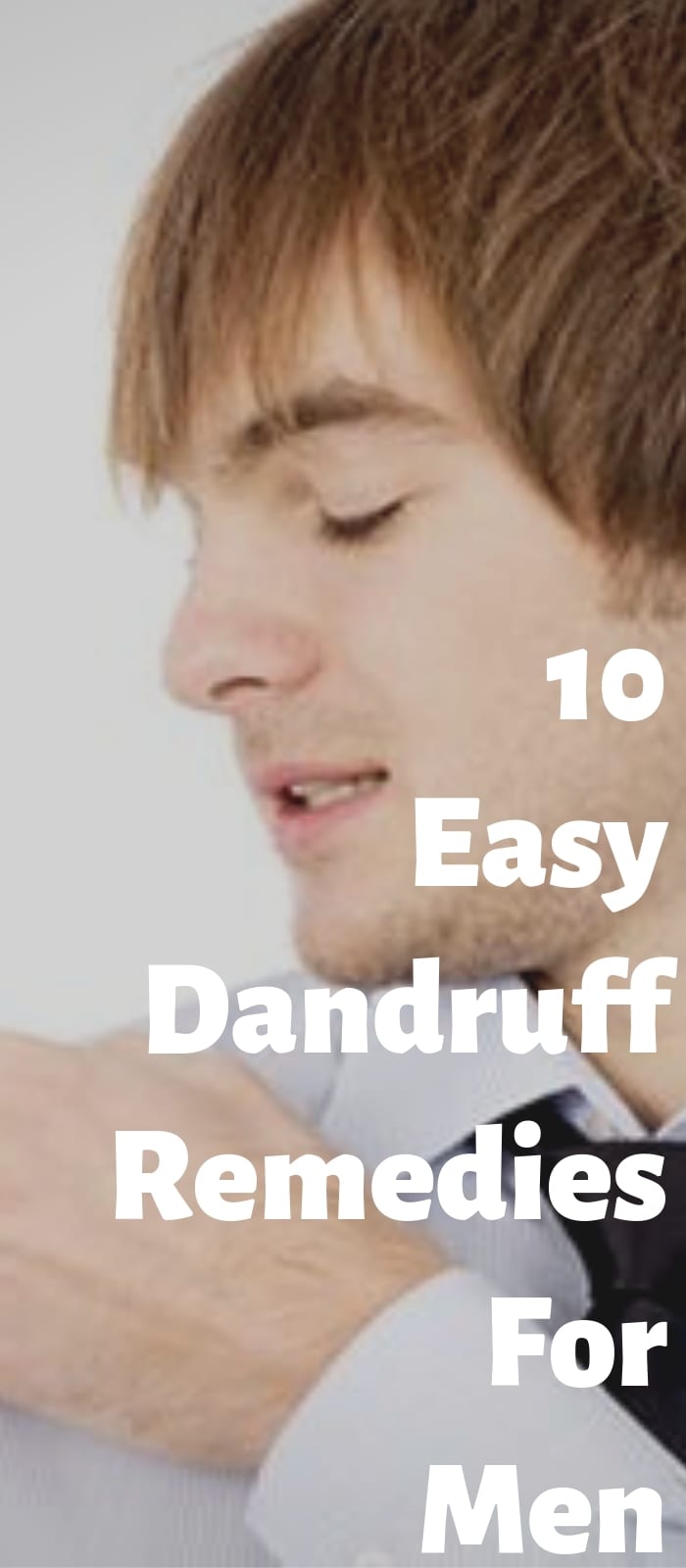 10 Easy Dandruff Remedies For Men