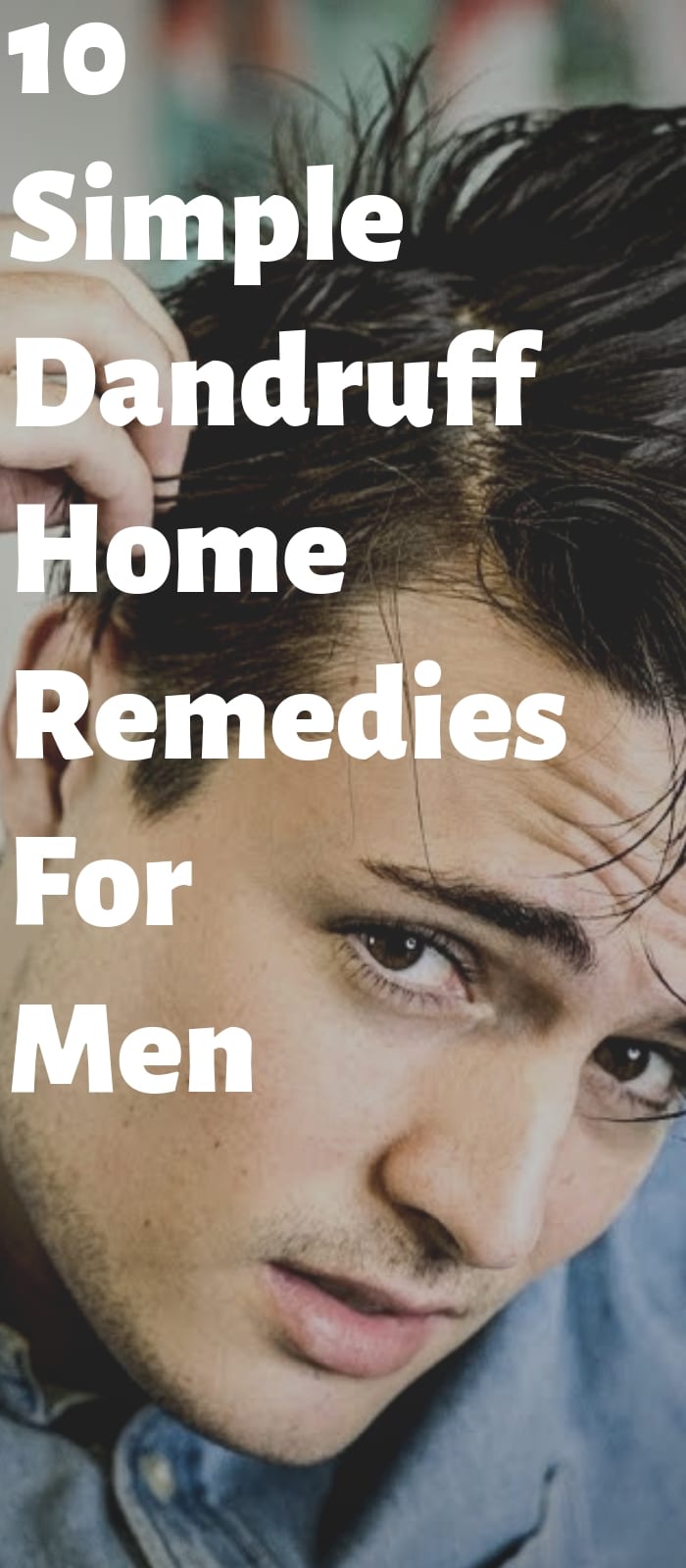 10 Easy Dandruff Remedies For Men!