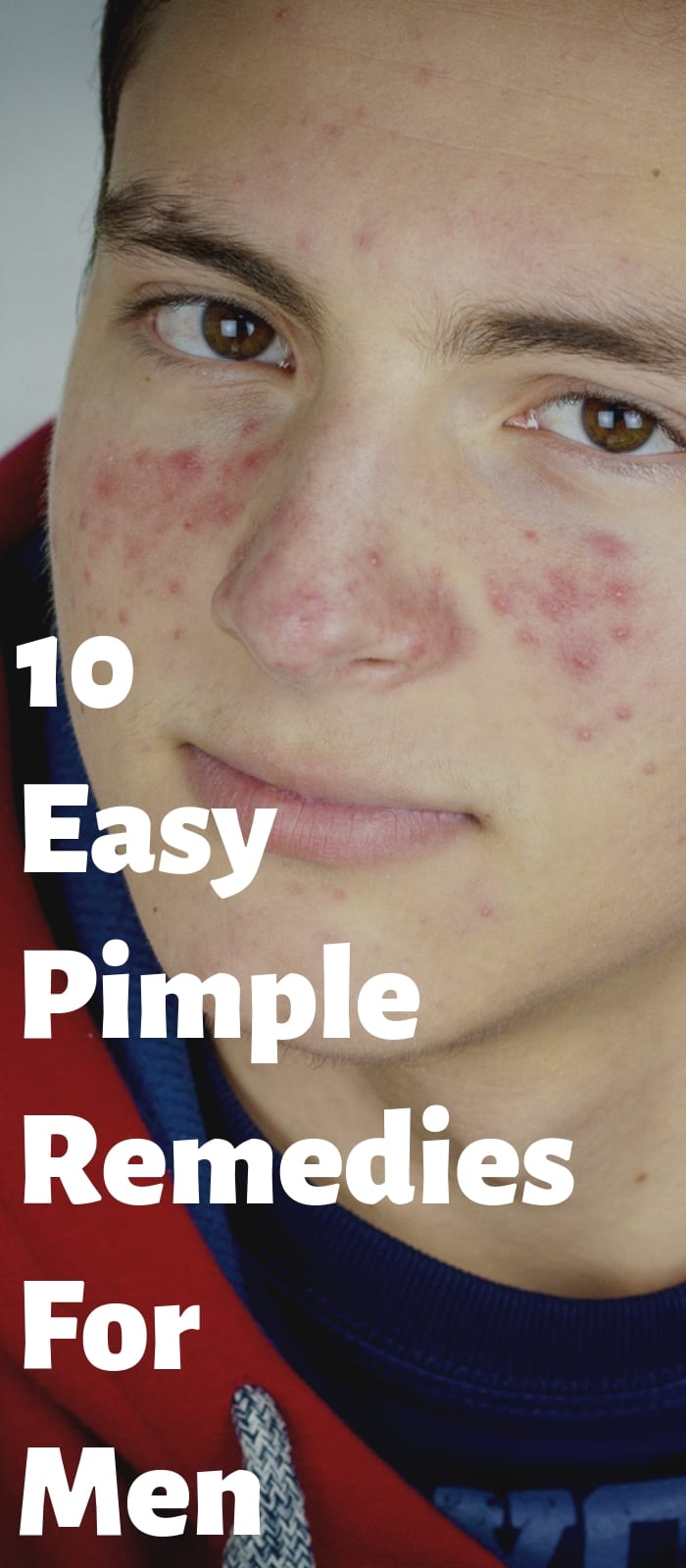 10 Easy Pimple Remedies For Men.