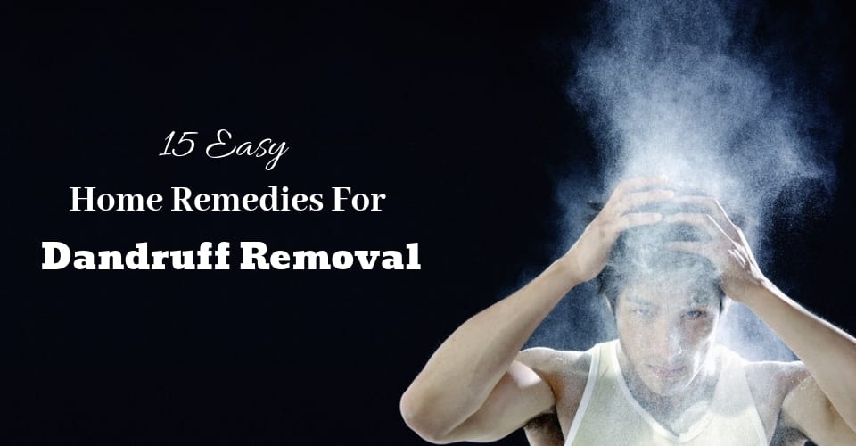 15 Easy Home Remedies For Dandruff Removal